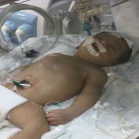 #نور عبدالعزيز محمد الخالدي ترقد في مستشفى الحبيب بسبب خطأ طبي