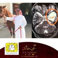 الدليهي ما ترى مكروه .