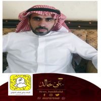 #الحواس نائب لمدير مستشفى #المذنب.